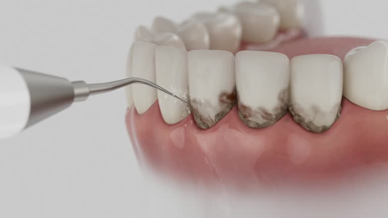 Reliable Wisdom Tooth Removal contractor in Clarke County County, MS by Dentist Open Now